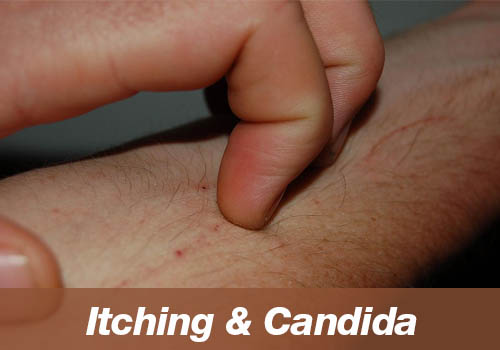 candida and itching connection