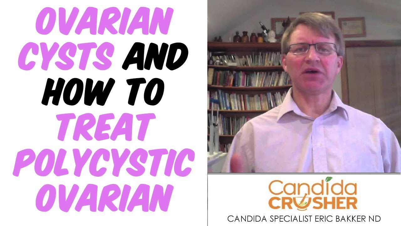 Polycystic Ovarian Syndrome A Treatable Condition Your Source for