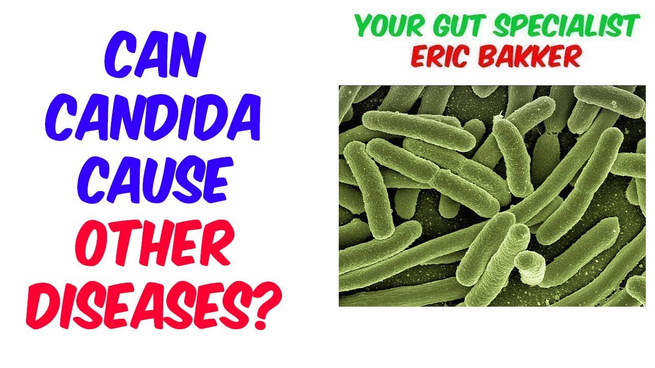 The Link Between Candida And Disease - YeastInfection.Org - Your Source