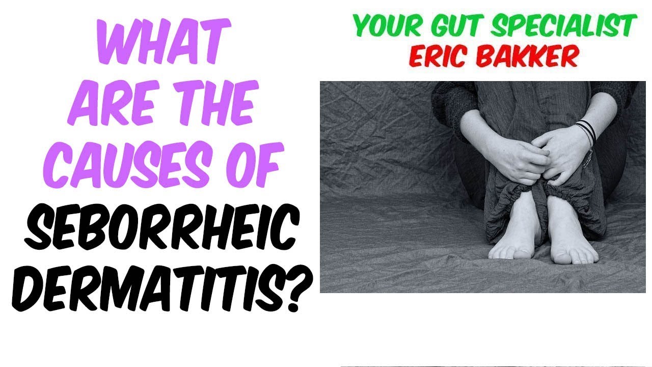 Seborrheic Dermatitis What You Need To Know Your Source for Candida