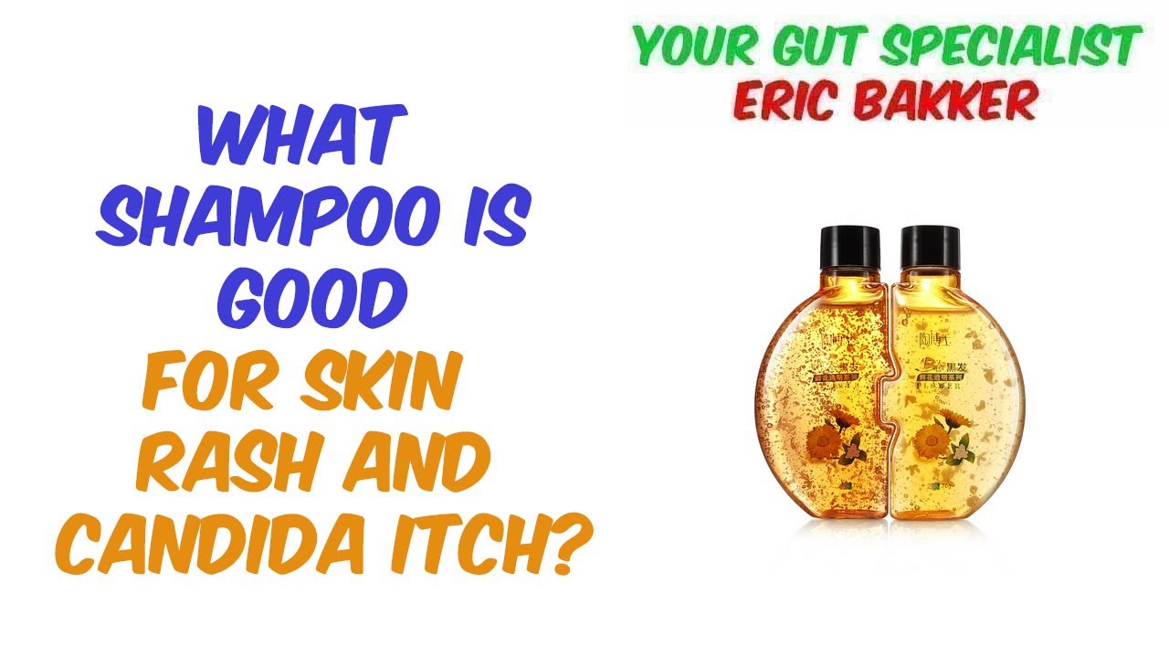 Shampoo For Your Itchy Scalp Your Source for